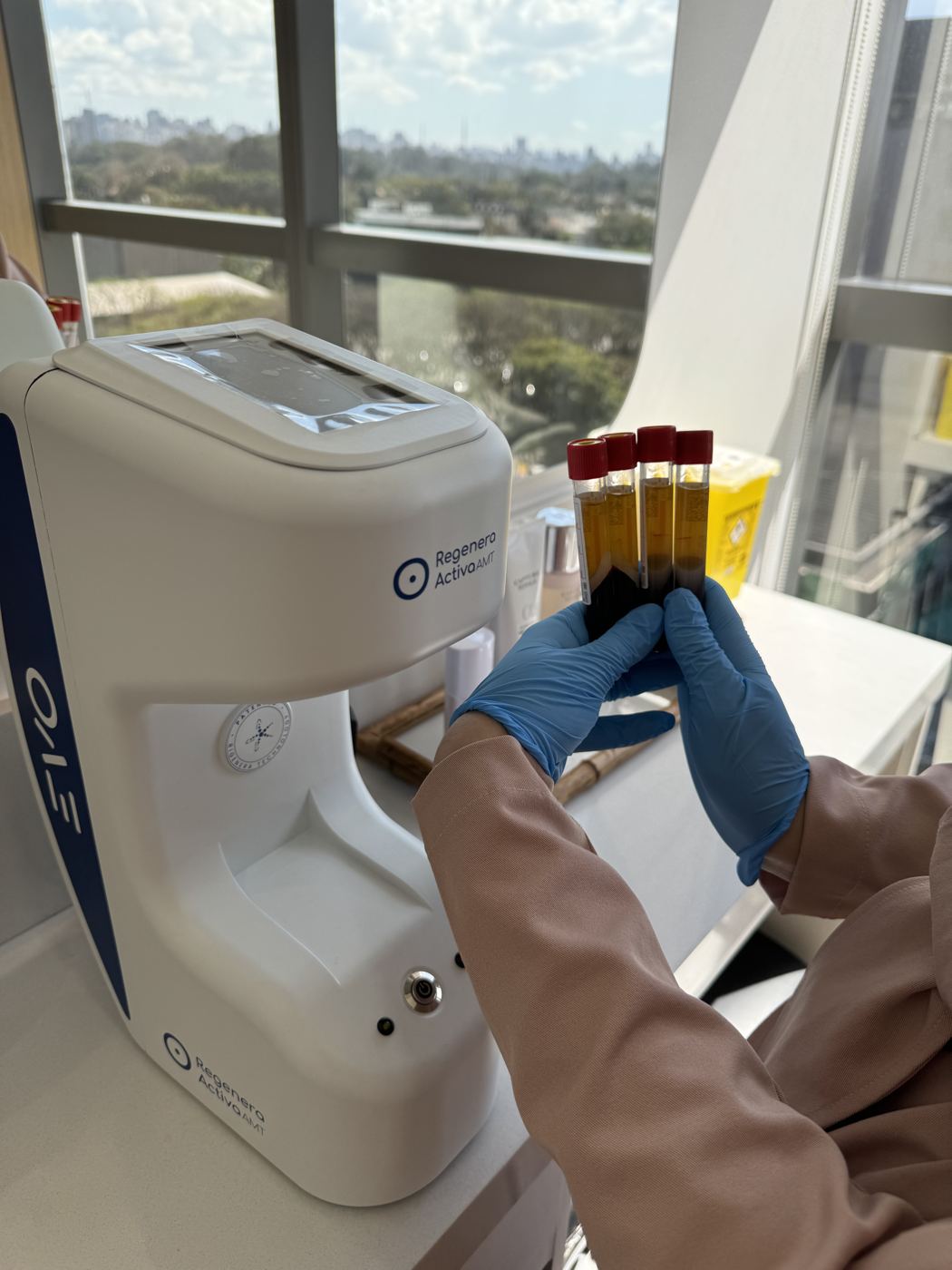 Equipamento de medicina regenerativa capilar e tubos de PRP na Casa Moreira